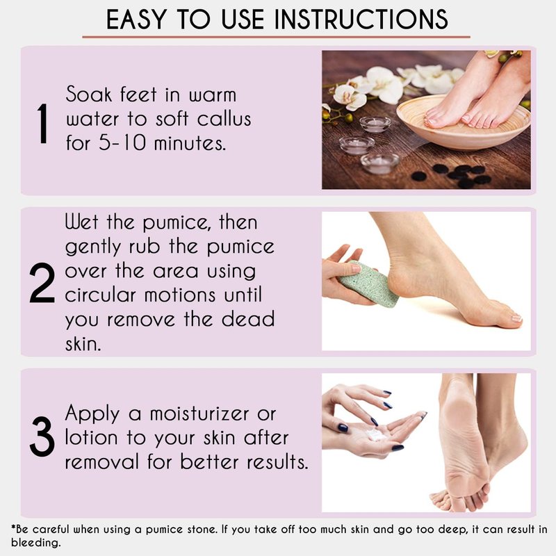 Professional Pedicure Foot Pumice Stone - 2-Sided Callus Remover & Dead Skin Scrubber | Ideal for Smooth Feet