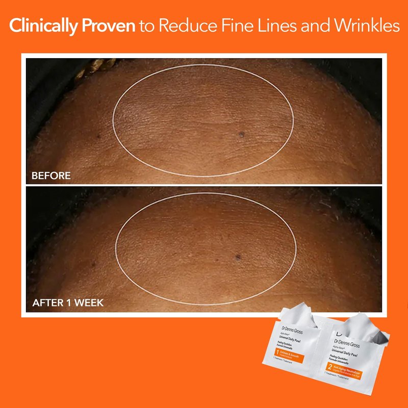 Dr Dennis Gross Alpha Beta Universal Daily Peel, As shown in the image, 30 Count