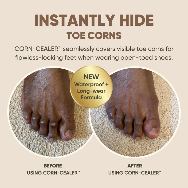 Regine Switzerland Toe Corn Makeup - Instant Coverage for Corns & Blemishes | Waterproof | Mocha