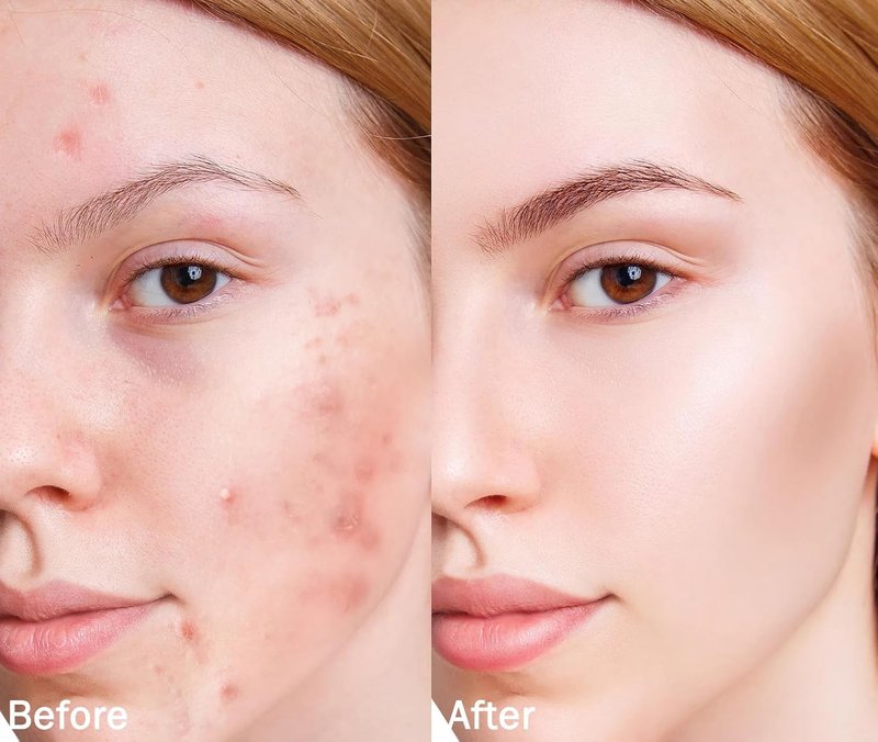 Skiennix 4-in-1 Color Changing Foundation - Medium Spectrum Full Coverage with SPF 50+ | Longwearing & Waterproof