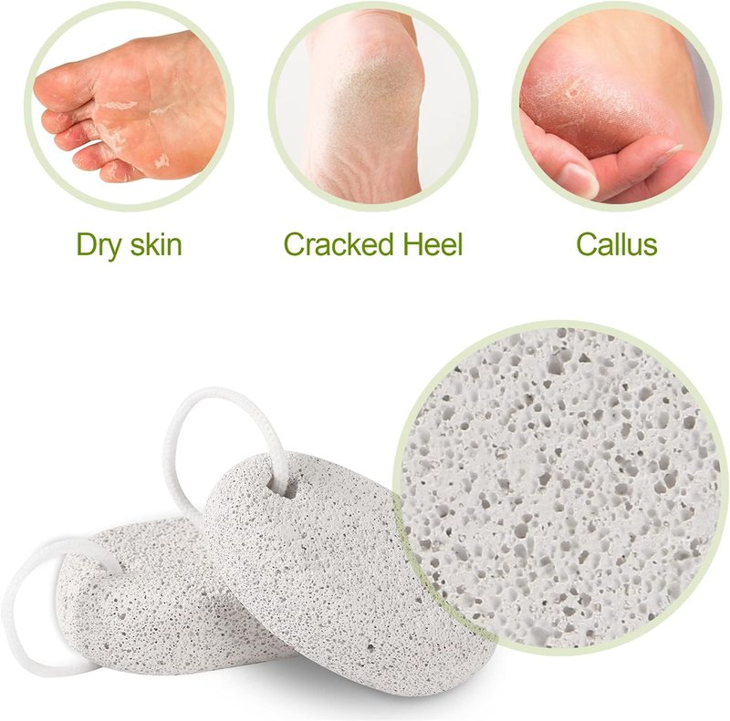 Natural Pumice Stone Set - Effective Callus Remover for Feet & Hands | Exfoliating Pedicure Tools (2PCS)
