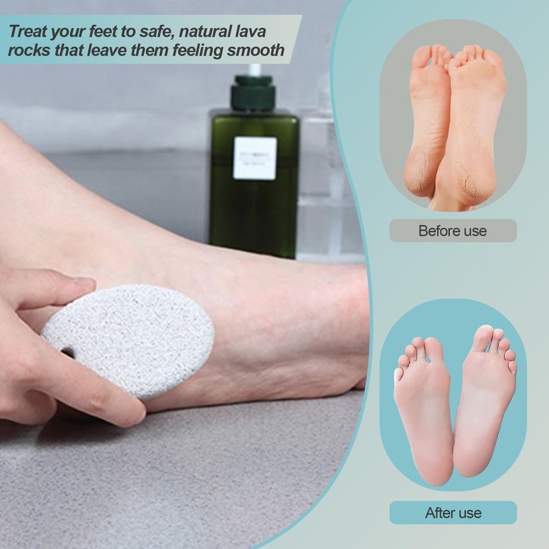 robwibw 2 Pack Foot Pumice Stone for Feet,Pumice Stone for Feet and Hands Pedicure Tools Hard Skin Callus Remover Pumice for Hanging in Shower