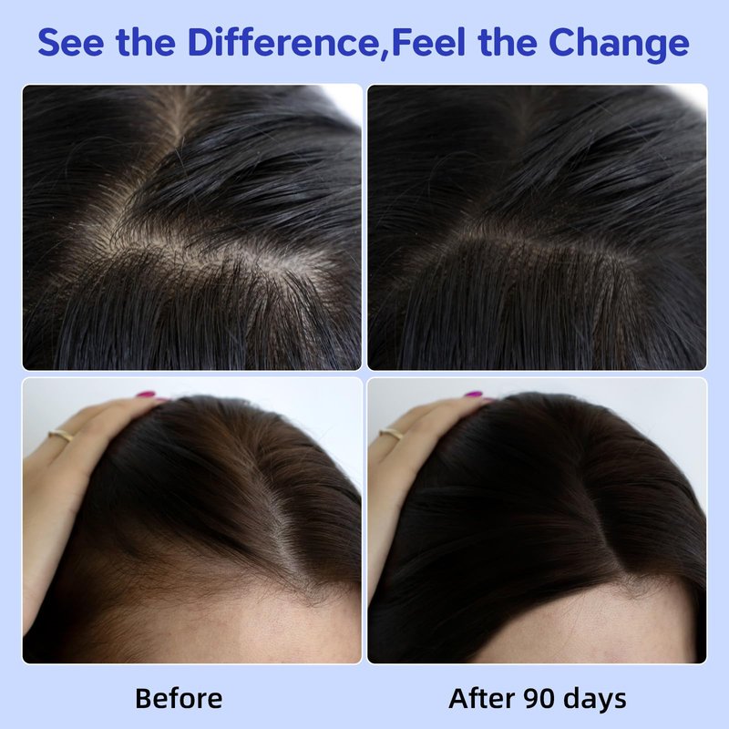 100% Natural Hair Oil with Rosemary & Saw Palmetto, Nourishing Treatment for Dry Damaged Hair, Smooth Frizz & Strengthen Strands for Silky Soft Shine