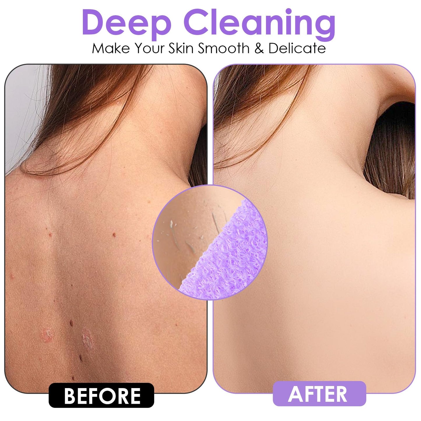 3 Pcs Back Exfoliator Body Scrub Towel, Double-Sided Back Loofah for Shower for Daily & Deep Skin Cleaning, Bath Backs Scrub Washcloth for Men & Women