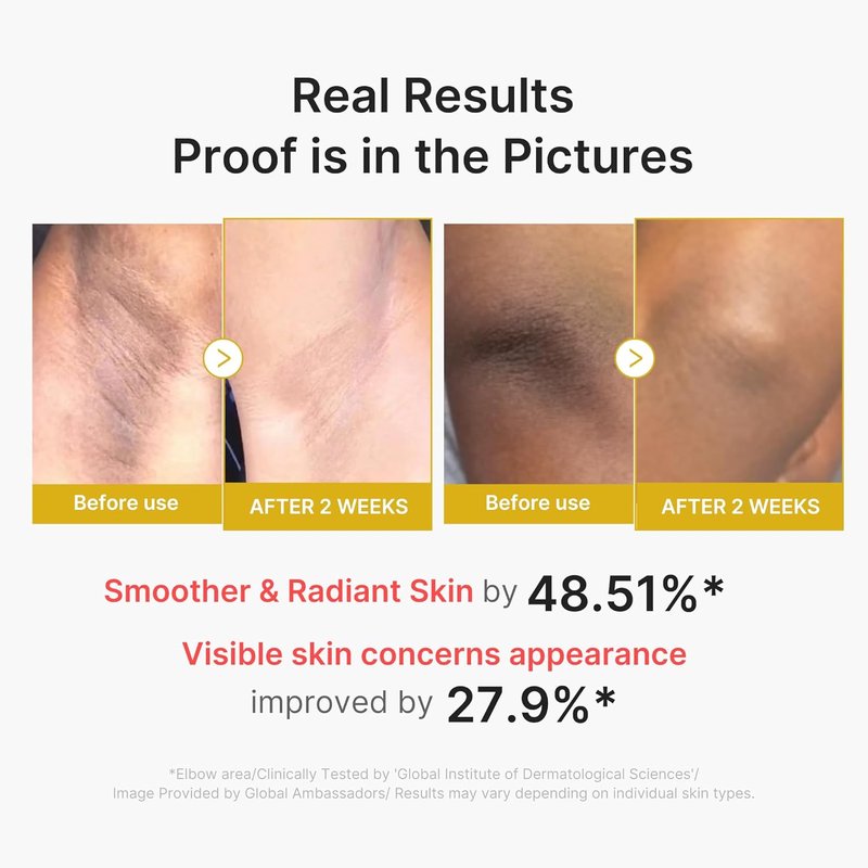 Medicube Body Peel Shot - Gentle Exfoliating Serum with Kojic Acid & Turmeric | 9.46 fl. oz for Brightening & Smoother Skin