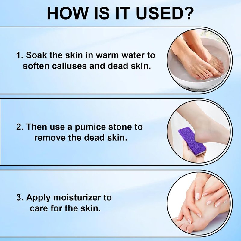 Skiennix Foot Pumice Stone - Double-Sided Callus Remover & Scrubber | 2 Pack in Purple