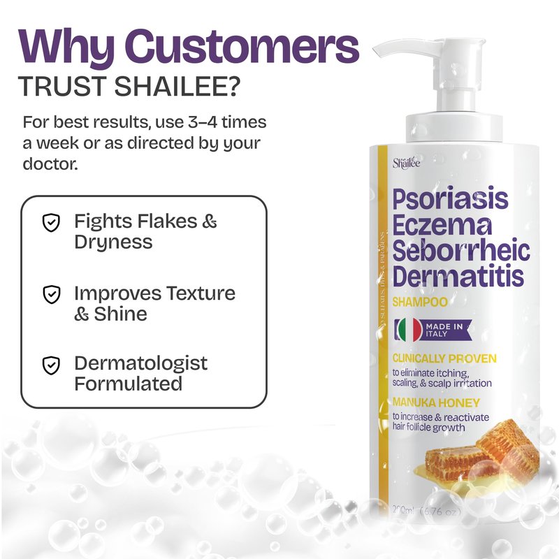 Psoriasis Shampoo for Eczema, and Folliculitis Treatment - Seborrheic Dermatitis Antifungal Shampoo for Ringworm, Acne, Flaking, Dry & Itchy Scalp Treatment - Psoriasis Relief with Manuka Honey