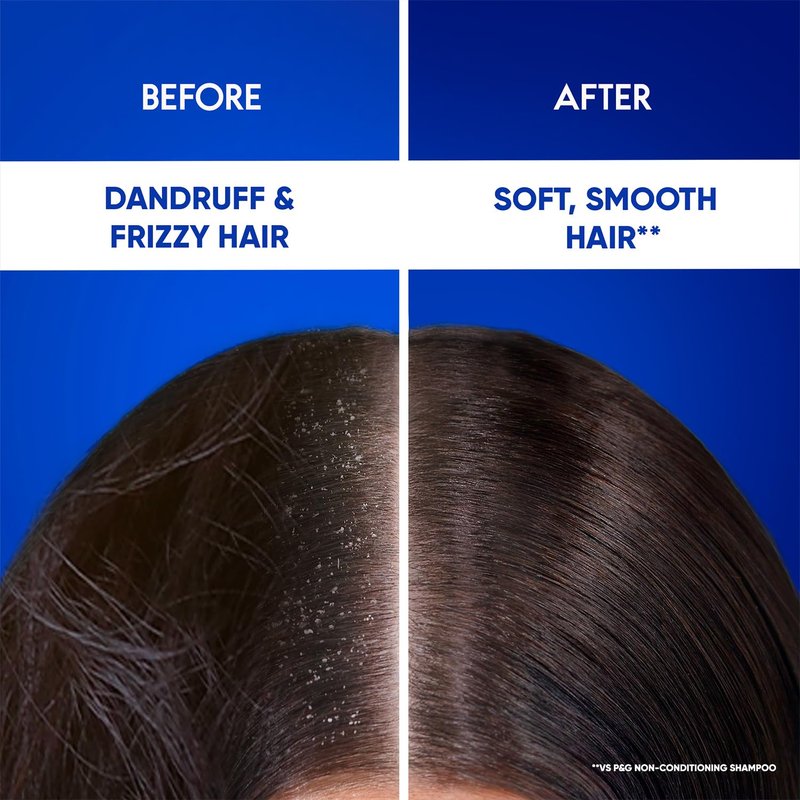 Head & Shoulders Smooth and Silky 2-in-1 Anti-Dandruff Shampoo & Conditioner | 180ml