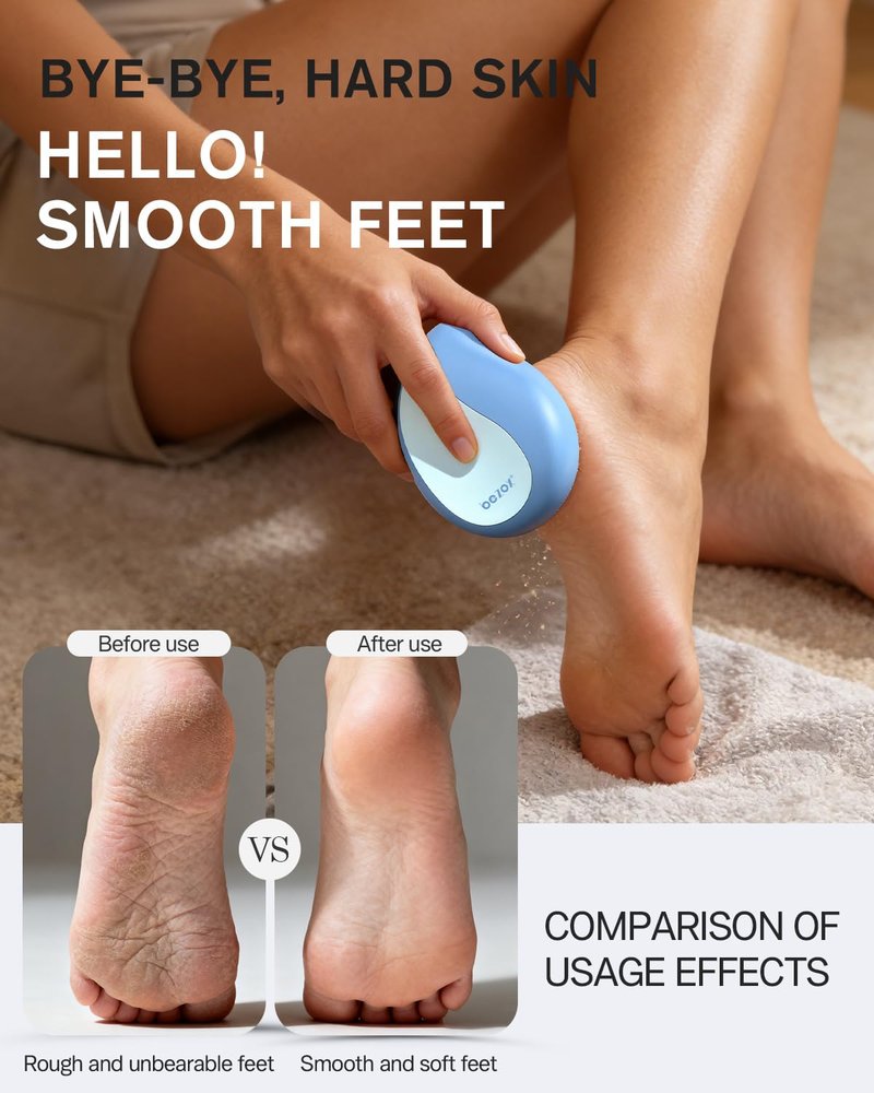 BEZOX Glass Foot File Callus Remover – Professional Foot Scrubber for Dead Skin & Cracked Heels – Premium Pedicure Tools for Travel with Protective Cover - Blue