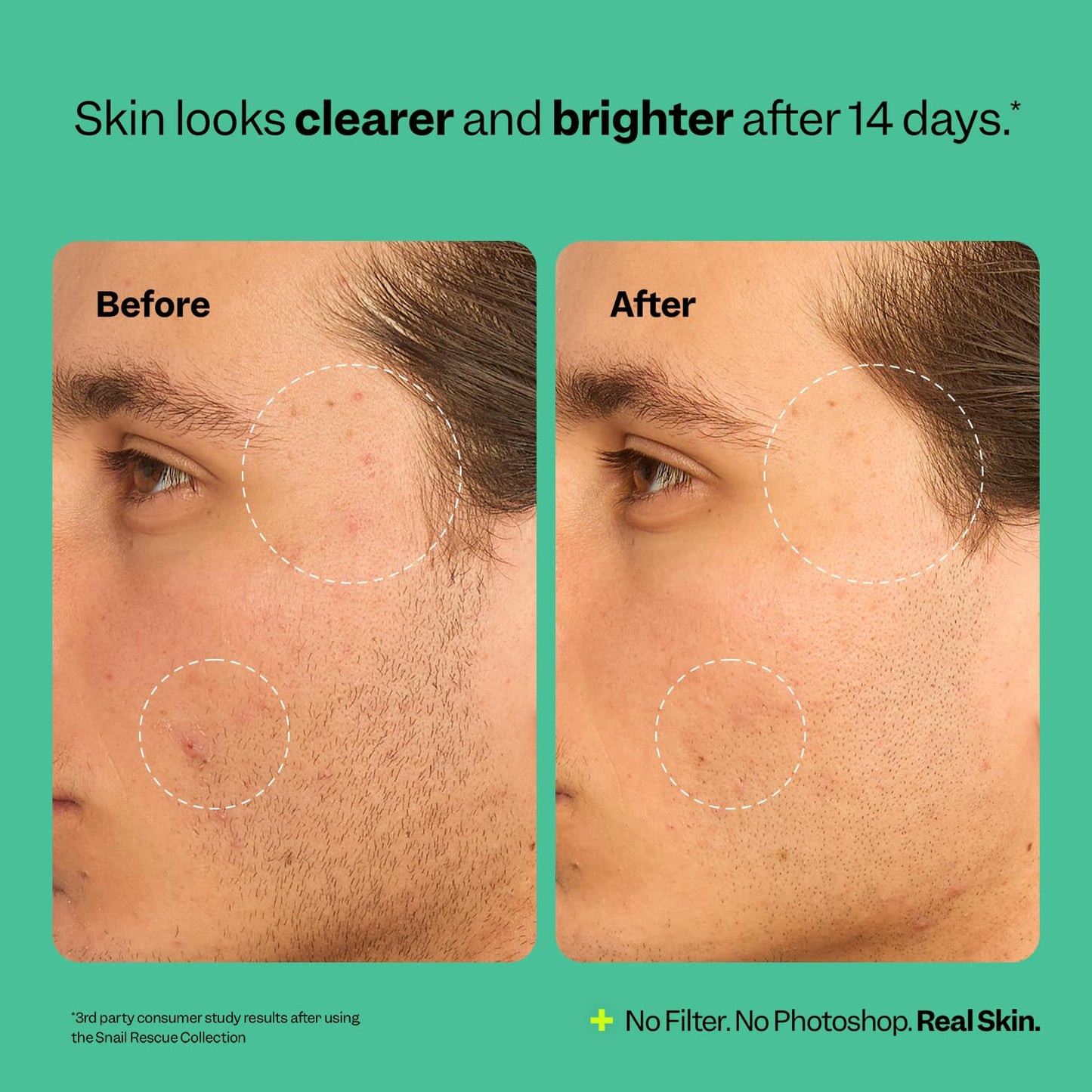 Peach Slices - Snail Rescue Blemish Busting Toner (4.05 oz) - 95% Snail Mucin Concentrate - Clarify, Strengthen, Balance - Hyaluronic Acid & CICA - Clean & Cruelty Free - Korean Skin Care & Beauty