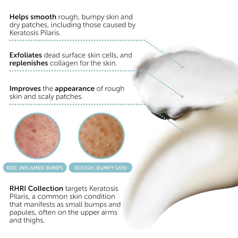 KP Bump Eraser Body Set with 10% AHA | Keratosis Pilaris Treatment | Keratosis Pilaris Lotion | Exfoliating Body Scrub | Ingrown Hair Treatment | Bundle Set for Bump, Strawberry Legs, Redness, Dryness