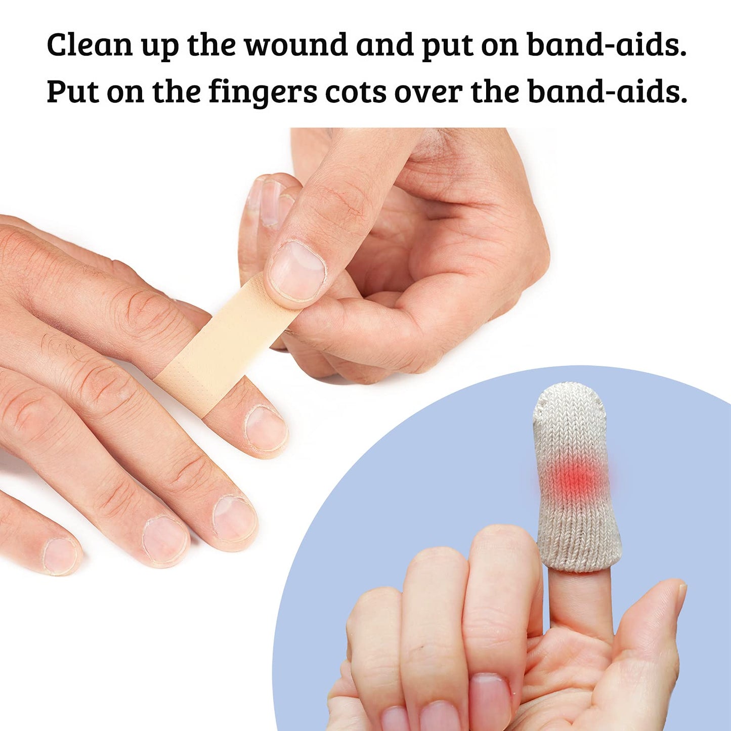 MIG4U 20 Pcs Cotton Finger Cots, Reusable Finger Protectors for Cuts Wounds, Arthritis, Eczema, Bruises, Calluses, Cracking Thumbs Healing, Fingernail Caps/Stall/Cushion/Cover, L/XL