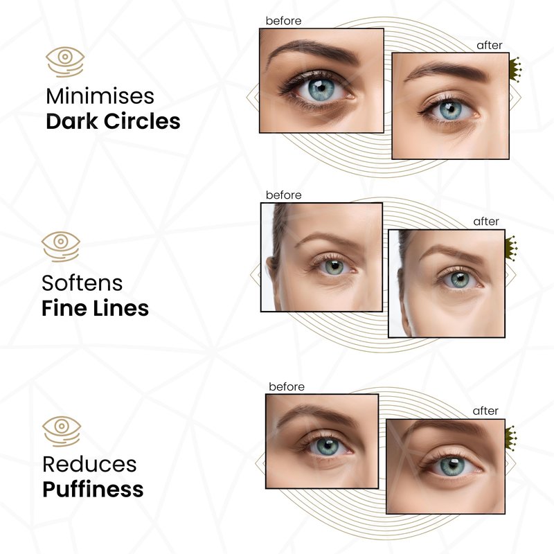 REVITALE 24k Gold Under Eye Collagen Patches, Reduce Puffy Eyes & Dark Circles, Illuminate Tired Eye Masks - Firms, Brightens, Energises (Packets - 10 Pair)