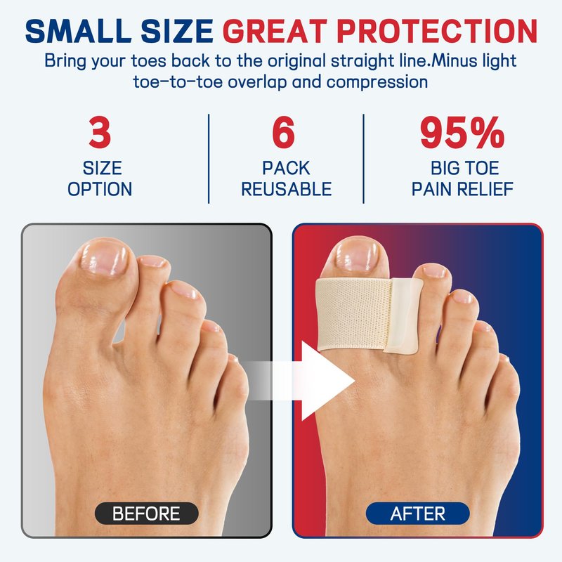 FULEEAN Big Toe Spacers,Hallux Valgus Corrector,Relieve Bunion Pain,Prevent Overlapping Toes, All-Day Comfort for Men & Women, Fits in Shoes.