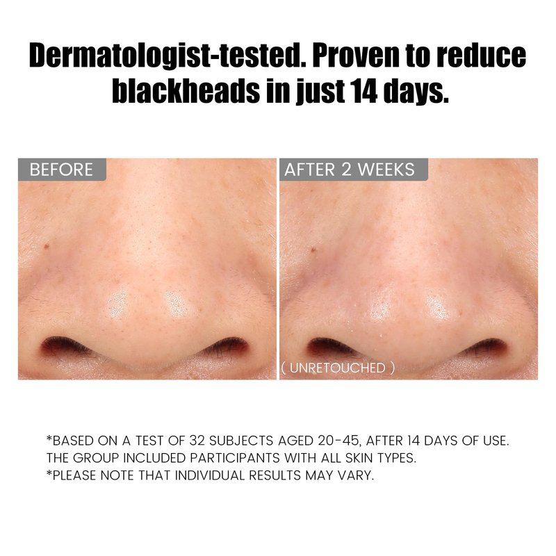 ConfidMiss Dual-Tube Refreshing Facial Cleanser, with Double Micro-Fine White Clay Centella Asiatica Pore Cleaning Blackhead Sunscreen Remover Daily Face Amino Acid Cleanser For Oily Skin 1PC