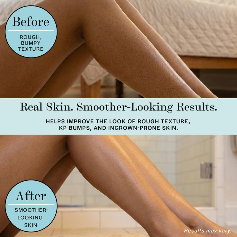 Base Laboratories Ingrown Hair - KP Bump Exfoliating Body Scrub - with AHA+BHA - Keratosis Pilaris Treatment - Daily Skin Exfoliant - Helps Reduce Strawberry Skin & Razor Bumps - Men & Women 3oz