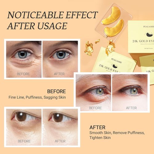 Under Eye Patches Gold and Hyaluronic Acid for puffy eyes,Rose Eye Masks for Dark Circles and Puffiness skin care Smooth Wrinkles products 30 Pairs
