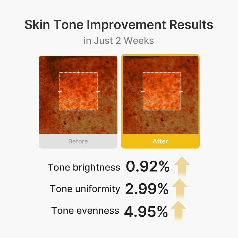 Medicube Capsule Cream - Kojic Acid & Turmeric for Uneven Skin Tone | Radiance & Tone Renewal | 1.86 oz