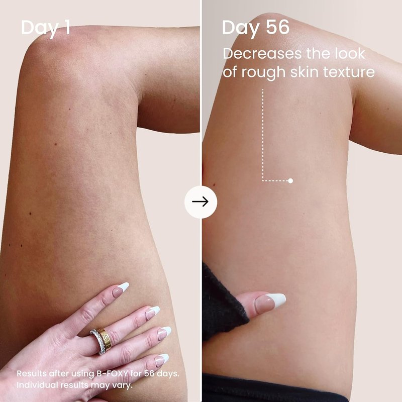 MAËLYS B-FOXY Inner Thigh Firming Cream - Skin Tightening & Nourishing Coconut Oil - 3.38 Fl Oz for Smooth, Toned Legs