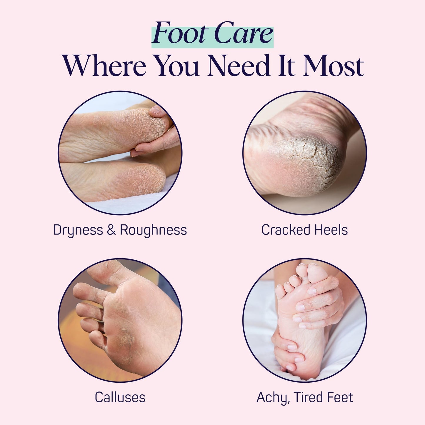 SpaLife Moisturizing Foot Sockies | Foot Mask For Dry Cracked Feet | Tea Tree Oil Softening Booties | Callus Remover Alternative | Self Care Gifts for Women | 8 Pack