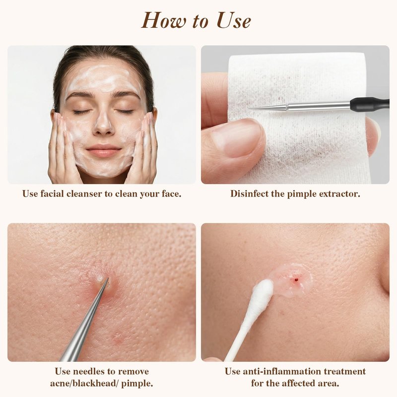 6 Pcs Pimple Extractor Tool Kit, Stainless Blackhead Remover Tools, Professional Comedone Pimple Popper Tools with Leather Bag