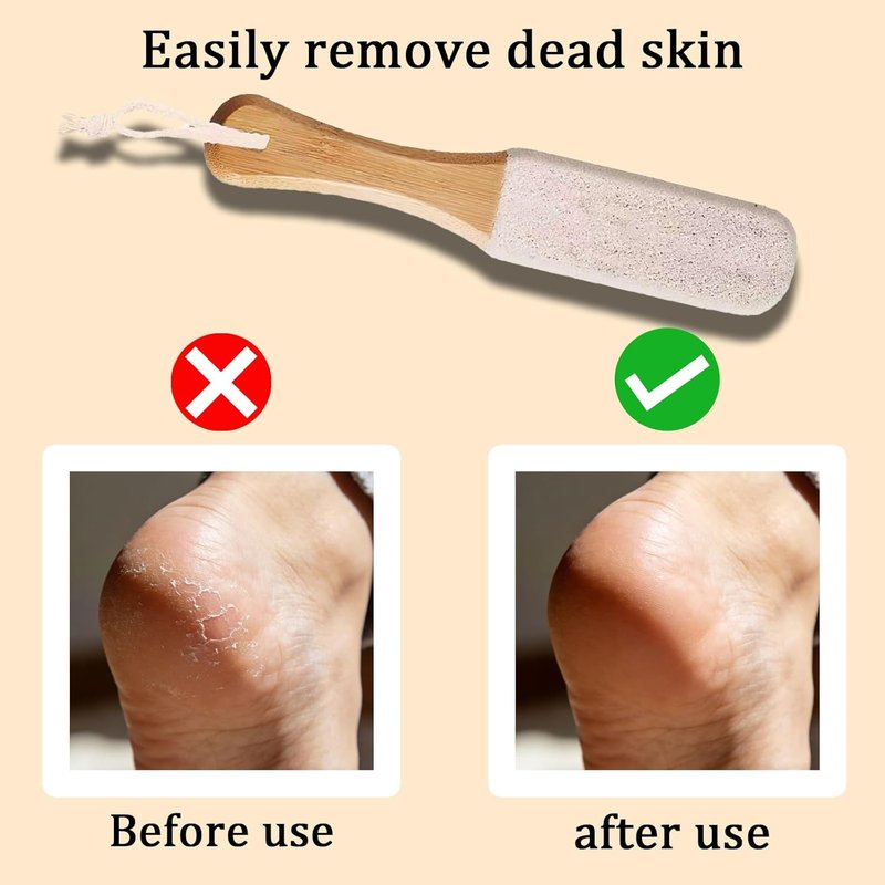 Professional Pedicure Foot File & Pumice Stone Set - Callus Remover with Wooden Handle for Smooth Feet | 2-Pack