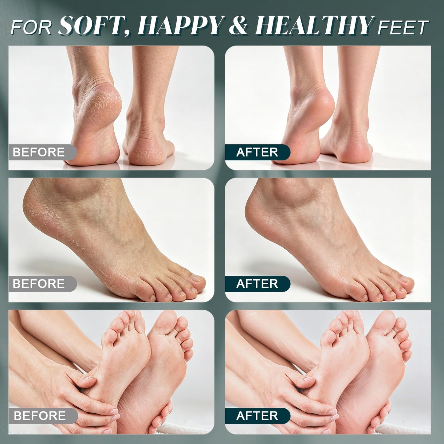 【Sea Salt Exfoliating Scrub】 – Foot Care Scrub for Dead Skin, Calluses & Cracked Heels – Gently Buffs Rough Dry Feet, Hydrating Foot Polish