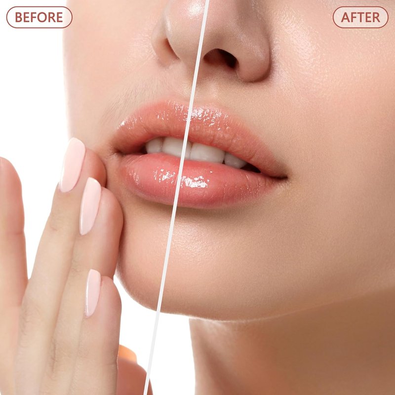 Facial Hair Remover for Women - Painless Electric Face Shaver | Rose Gold, Ideal for Lips & Peach Fuzz