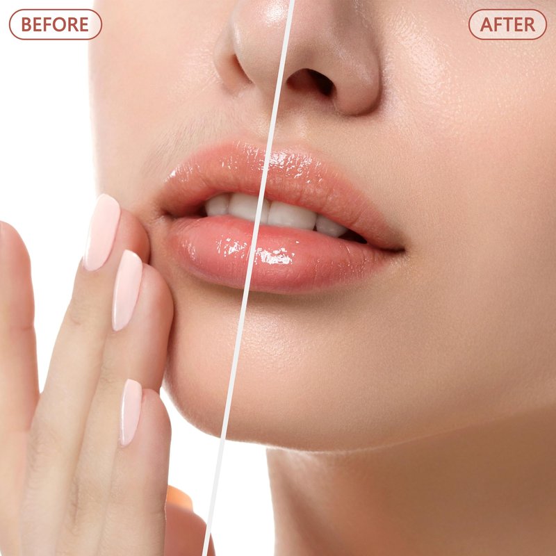 Facial Hair Remover for Women - as Seen on TV Painless Face Shaver - Electric Hair Removal Device for Face Lips Peach Fuzz with Light (Blue)