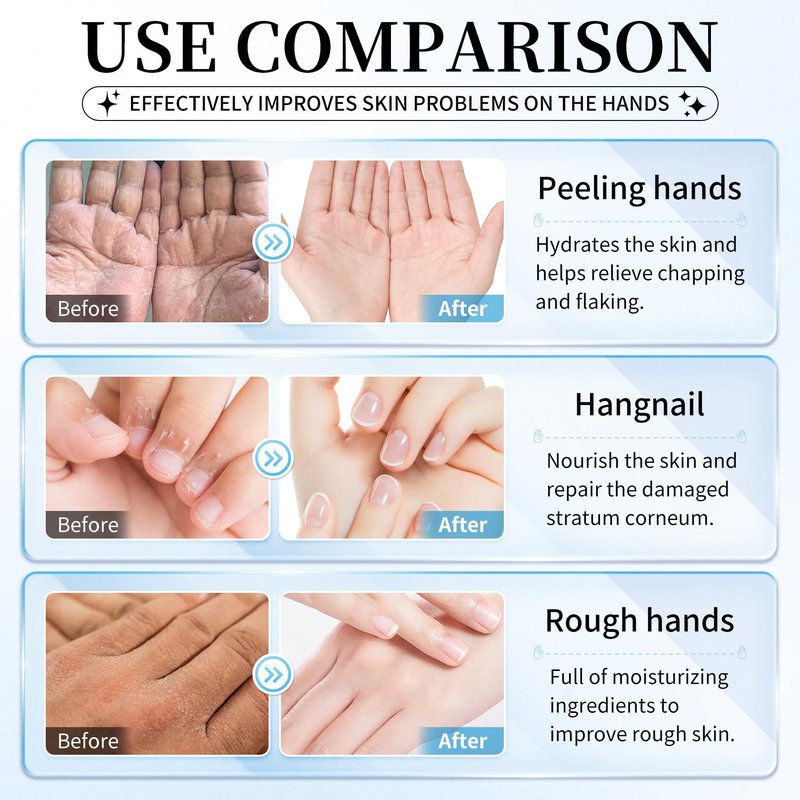 AIUEO 10 PCS Hand Mask Moisturizing Gloves, Hydrating Hand Masks for Dry Cracked Hands, Exfoliating Hand Peeling Mask, Nourishing Collagen Gloves for Hands