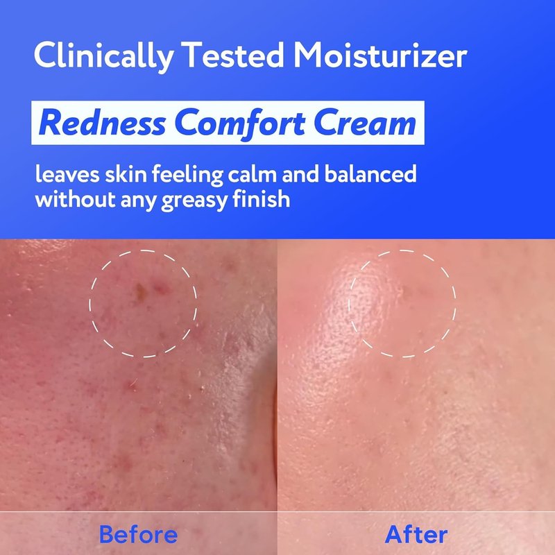 Skiennix Coconut Hydro Barrier Cream - Soothing Moisturizer with Panthenol & Ceramide | Non-Greasy, Fragrance-Free (80ml / 2.7 fl oz)
