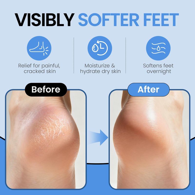 Silicone Moisturizing Socks for Women Men Large- 2Pairs Foot Moisturizer Socks for Dry Cracked Feet- Black Aloe Spa Moisture Hydrating Foot Care Socks (L Up to Size 12)