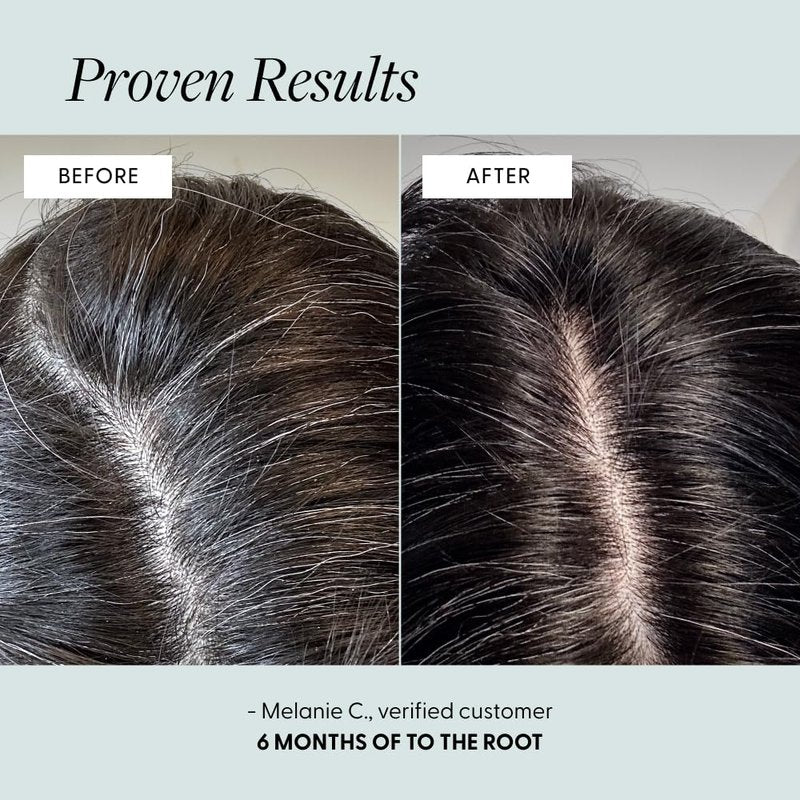 Arey To The Root Hair Serum - Anti-Grey Formula for Healthier Hair | Slows Grey Growth in 3-6 Months | Vegan & Oil-Free