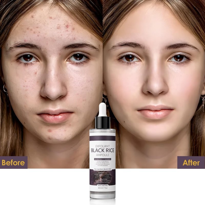 Peel Shot Glow Black Rice Exfoliant Peeling Ampoule, Soft Exfoliating Brightening Serum, Face and Body Scrub, Facial Exfoliator, Deep Hydration, 80ml