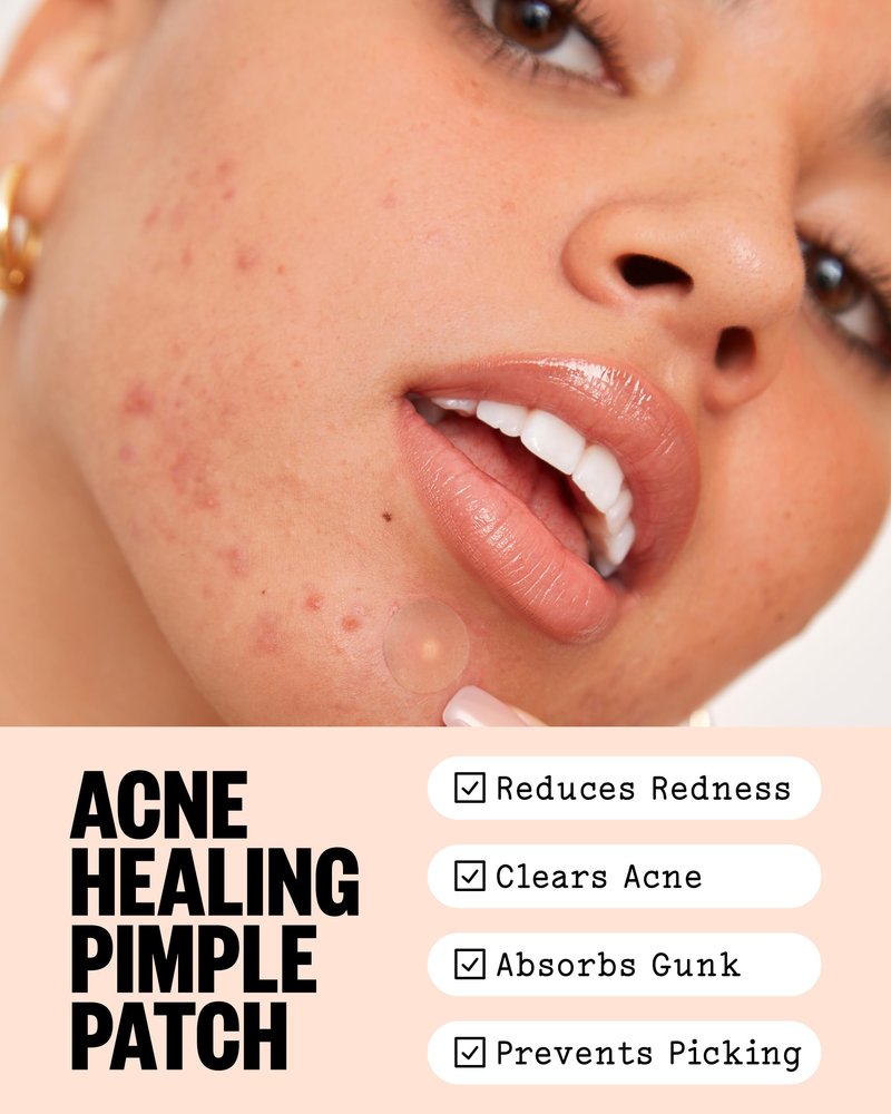 PEACE OUT Acne Healing Dots Hydrocolloid Pimple Patches, Acne Spot Treatment with Salicylic Acid, Retinol, and Aloe Vera for Blemishes and Breakouts (20 count)