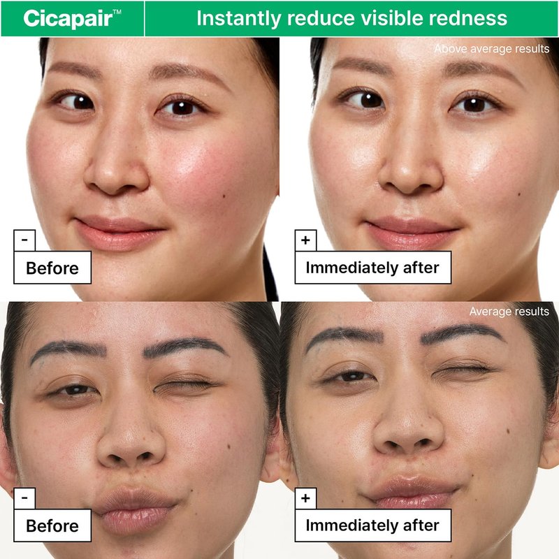 Dr.Jart+ Cicapair Face Moisturizer - Soothing Redness Relief & Barrier Repair with Centella Asiatica | Korean Skin Care