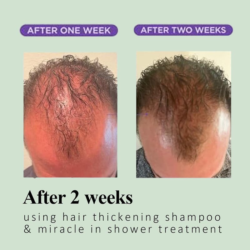 Organic Rosemary Scalp Balance Shampoo - Nourishing Formula for Thinning Hair | 2 Bottles