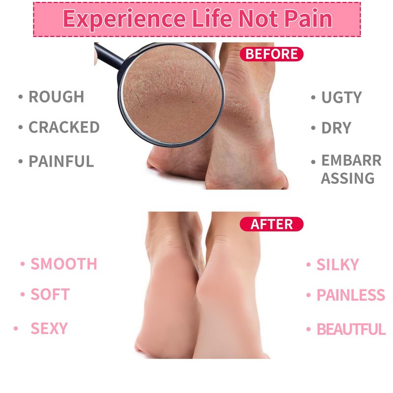 Giloner Foot Moisturizing Socks 2Pairs,Silicone Socks for Women,Gel Socks for Foot Care,Silicone Socks for Repairing and Softening Dry Cracked Feet Women-Self Care Gifts