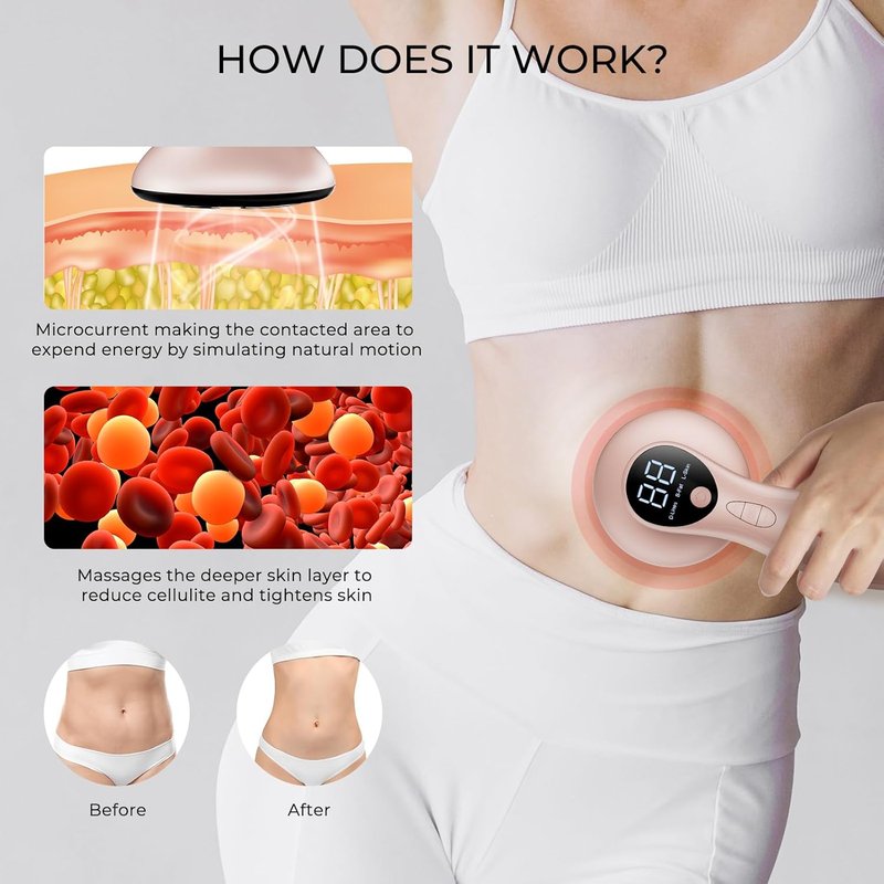 Skiennix Cellulite Massager - Electric Body Sculpting Machine for Skin Tightening | Tones Belly, Waist, Arms, Buttocks, Legs