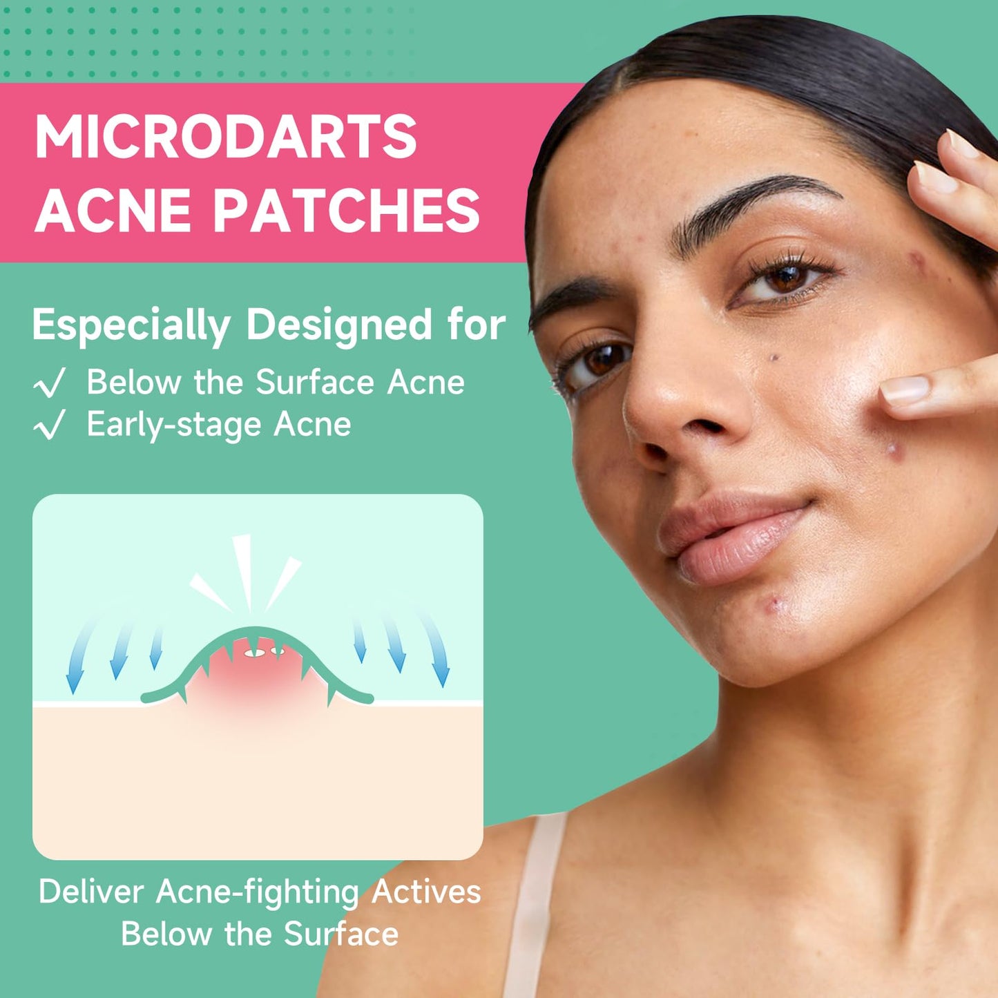 TEAWOO 36-Count Microdart Pimple Patches, Hydrocolloid Acne Patches with Salicylic Acid & Madecossoside, Microdart Zit Patches for Deep Blemishes & Early Stage Acne (Patented)