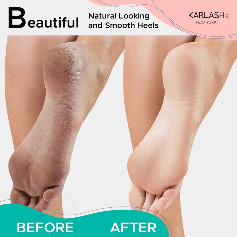 Professional Pedicure Foot Pumice Stone - 2-Sided Callus Remover & Dead Skin Scrubber | Ideal for Smooth Feet