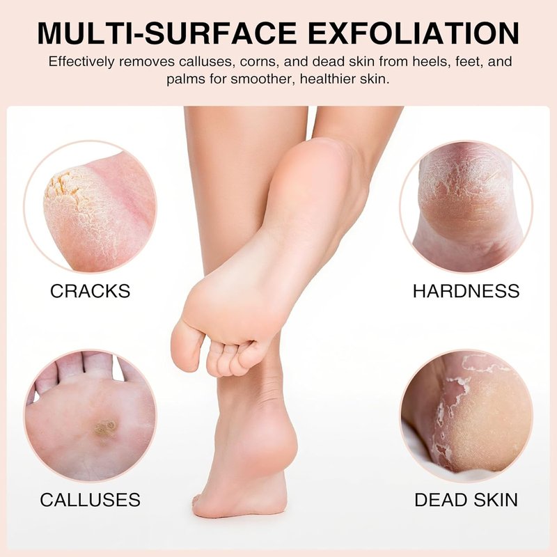 Natural Pumice Stone Set - 3 Oval Volcanic Lava Foot Scrubbers for Callus & Cracked Heel Exfoliation | 4 x 2.8 x 1.6 Inches