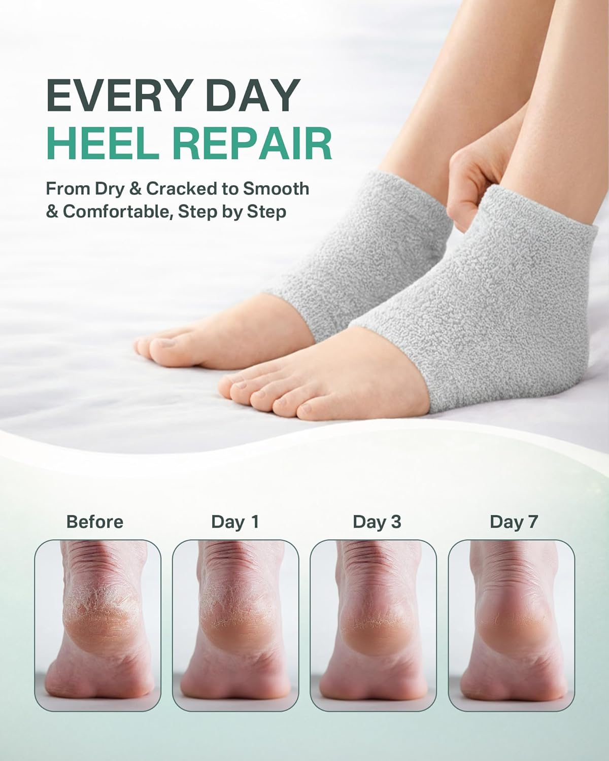 Skiennix Moisturizing Socks for Women - Deeply Hydrating Gel Socks for Dry, Cracked Heels | Size 9-11, Heel Gray