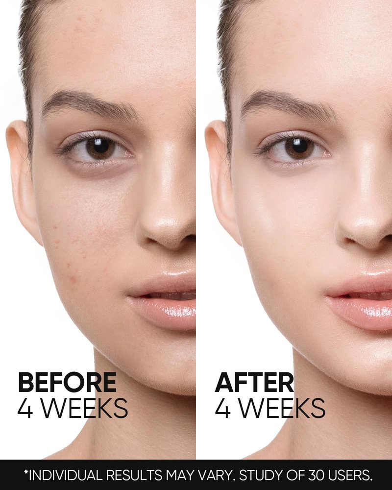 Face Moisturizer with 5X Ceramides, Hydrating Moisture Barrier Repair Cream for Sensitive/Oil Skin Types, Hyaluronic Acid & Centella (Retinol, 1 Fl Oz (Pack of 1))