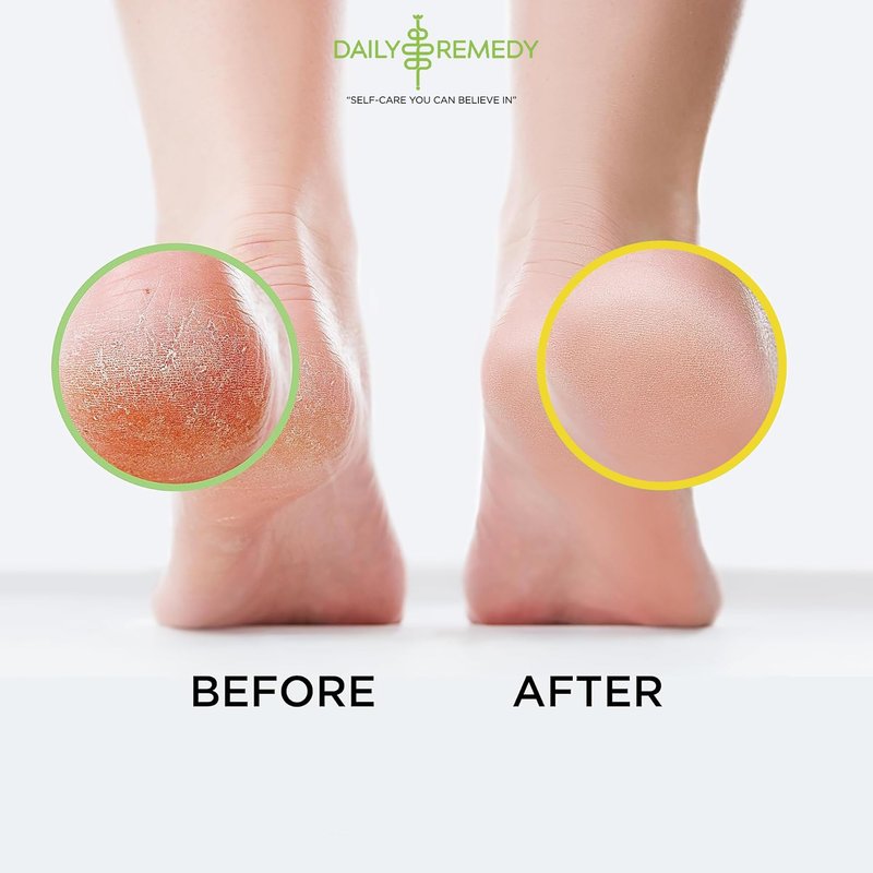 DAILY REMEDY Tea Tree Oil & Citrus Foot Soak Set, Pack of 2, for Foot Pain, Odor, Sore Feet, Athlete’s Foot, Soften Calluses - Natural Blend & Salts, Made In USA
