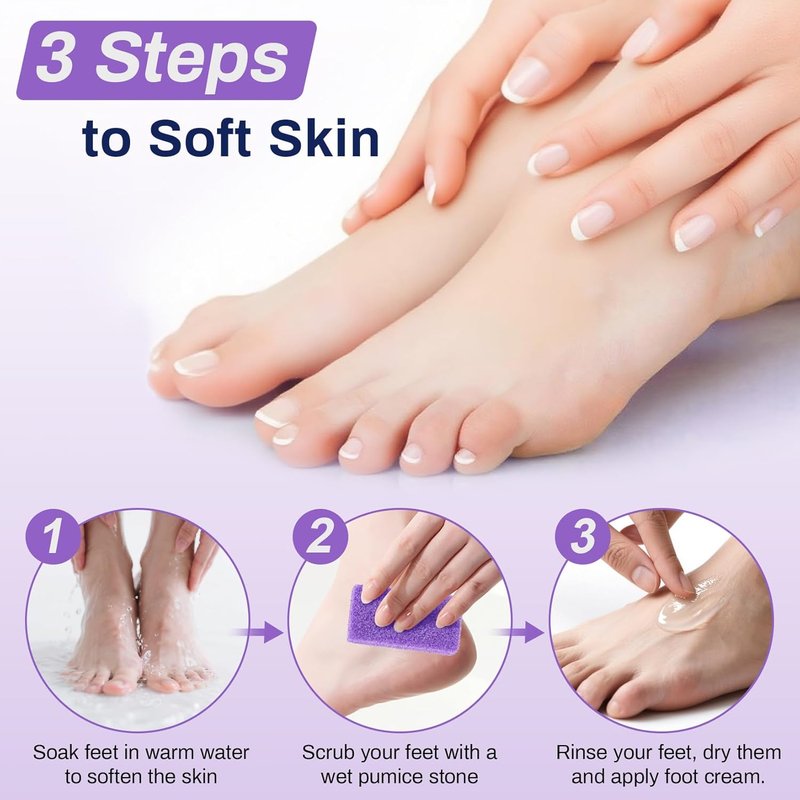Pumice Stone for Feet - 20 Pack Purple Foot File for Callus Removal | 3.6 x 1.8 x 0.47 Inch Exfoliating Scrubber