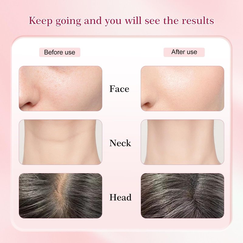 Multifunctional-Red-Light-Therapy-for-Face and Neck-Eye-Head Massager,7 Colors Skin Rejuvenation Lifting Facial Massager for Toning,Glow Boost,Wrinkle&Dark Circle Reducer (White)