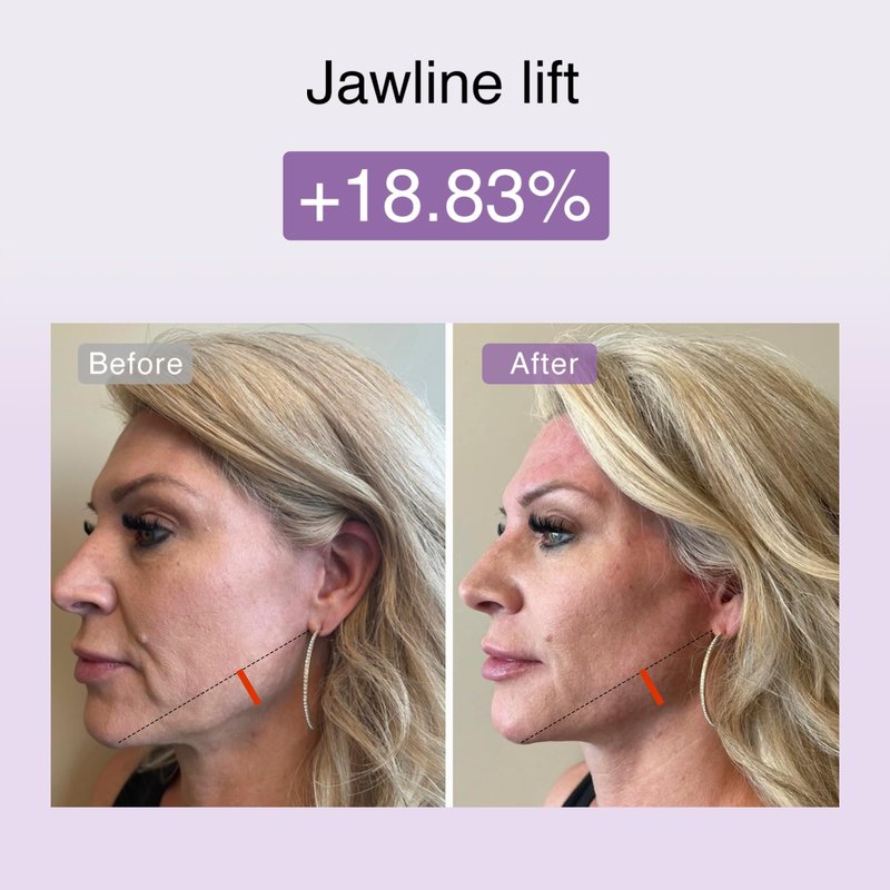 DermRays Multi-RF Microcurrent Device with 650nm Red Light, 4-in-1 Facial Toning Tool with Multi-Leading Tech for a Visibly Radiant & Youthful Appearance