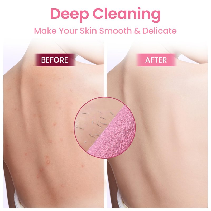 3 Pcs Double-Sided Back Exfoliator Body Scrub Towel, Exfoliating Back Scrubber with Handles,Exfoliating Washcloth Bath Tool in Shower, Stretchable Back Washer to Deep Cleans Skin (Pink)