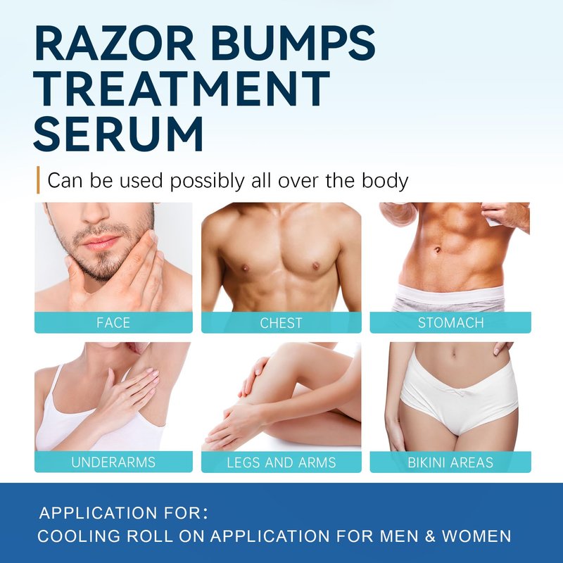Razor Bumps Ingrown Hair Treatment: 3.38fl.oz Smoothing Solution for Body, Beard & Bikini Area Post Waxing After Shaving Serum for Ingrown Hair & Razor Burn - Women & Men